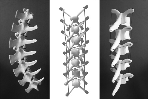 Chronischer Schmerz ist heilbar - Selbsterfahrung 3 TENSEGRITY SPINE
