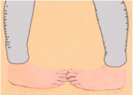 Beweglichkeitstest zur Selbsteinschätzung muskulärer Einschränkungen 8 innenrotation_max